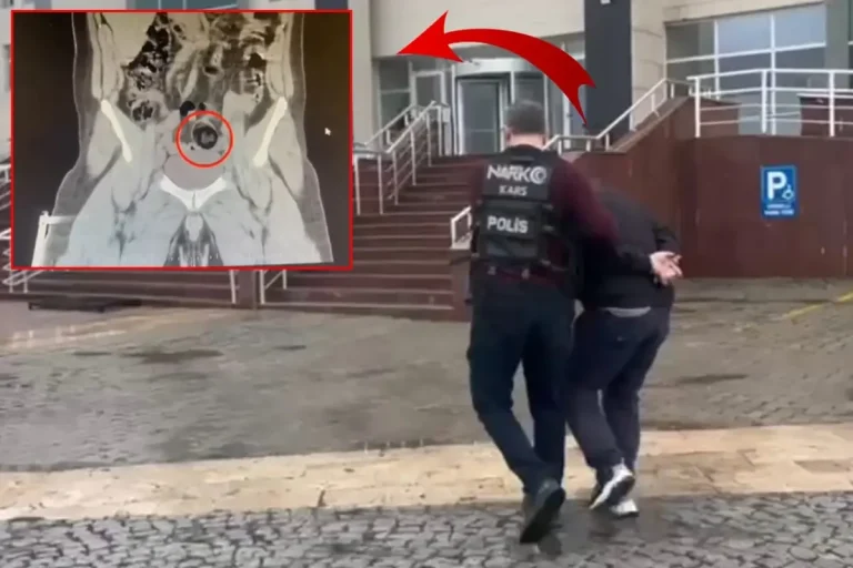 İranlı yolcunun makatından uyuşturucu çıktı