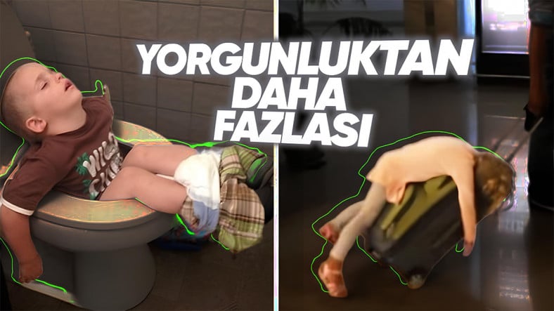 Olur Olmadık Yerde Uykuya Dalıp Birdenbire Uyanıyorsanız Işık Topu Üzere Narkolepsiniz Olabilir: Pekala Tedavisi Var mı?